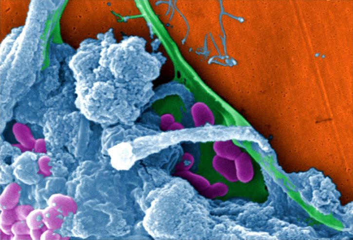 Novel Therapeutic Agent to Target Microbial Biofilms