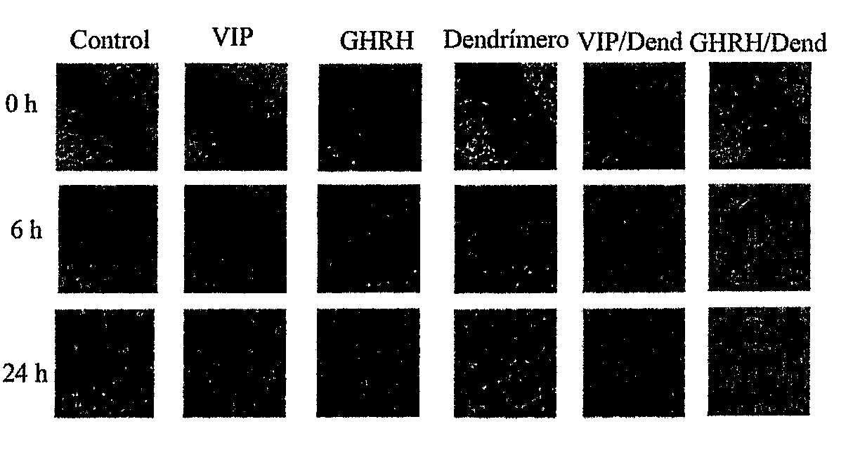 Nanoconjugates formed by dendritic molecules and peptides as antitumor agents against advanced prostate cancer.