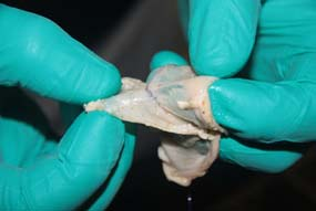 Automatic device for suture in anastomosis surgery interventions